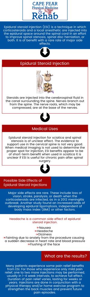 An epidural steroid injection (ESI) is a minimally invasive procedure that helps ease neck, arm, back, and leg pain brought on by irritated spinal nerves as a result of spinal stenosis or disc herniation. Cape Fear Physical Medicine and Rehab proudly provides epidural steroid injections to patients who are dealing with nerve pain and inflammation in their back or legs. Contact us today for more information, or simply schedule an appointment online! We are conveniently located at 1540 Purdue Dr, Ste. 200, in Fayetteville, NC 28303.